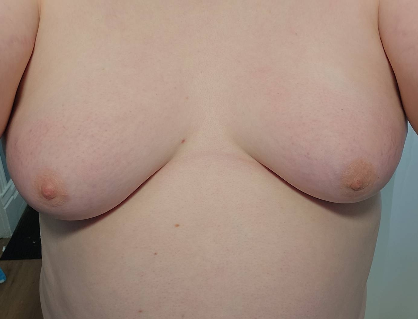 A picture of my breasts